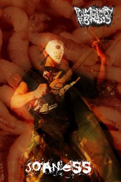 interview Pulmonary Fibrosis